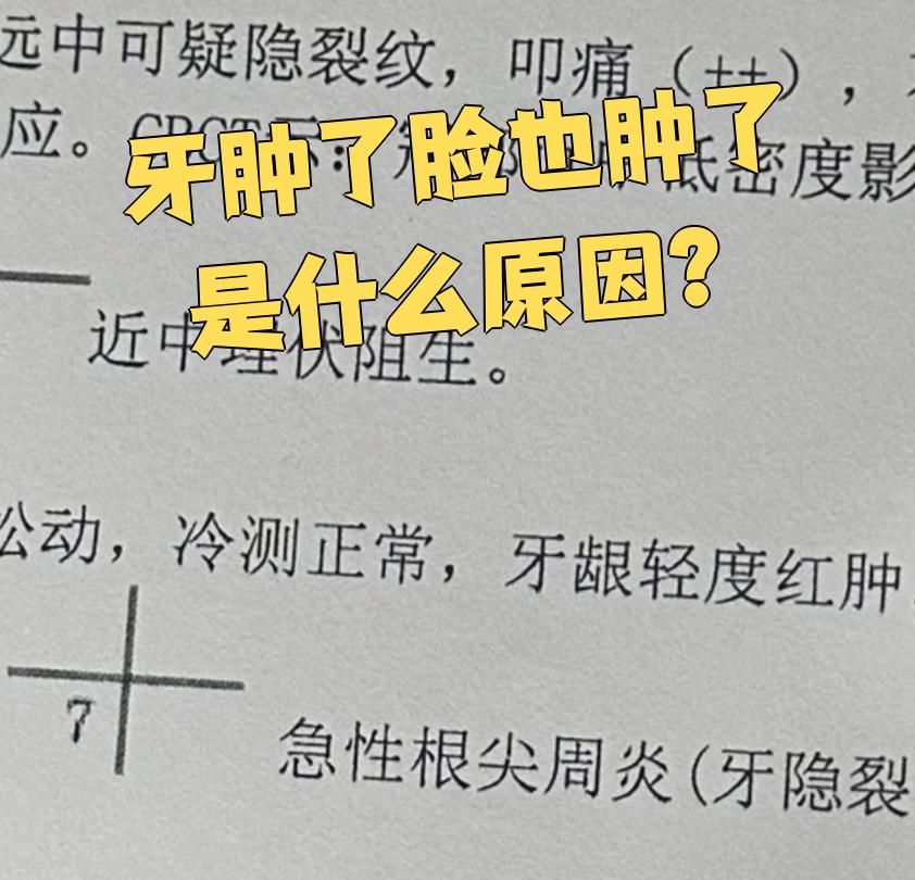 牙龈看着肿但不痛,是怎么回事