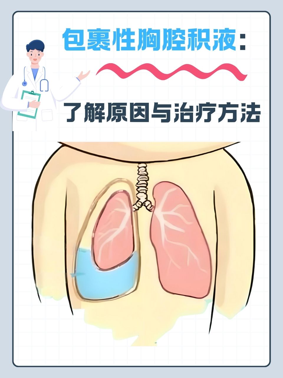 胸水怎么形成的?