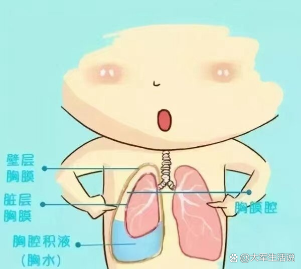 胸水怎么形成的?