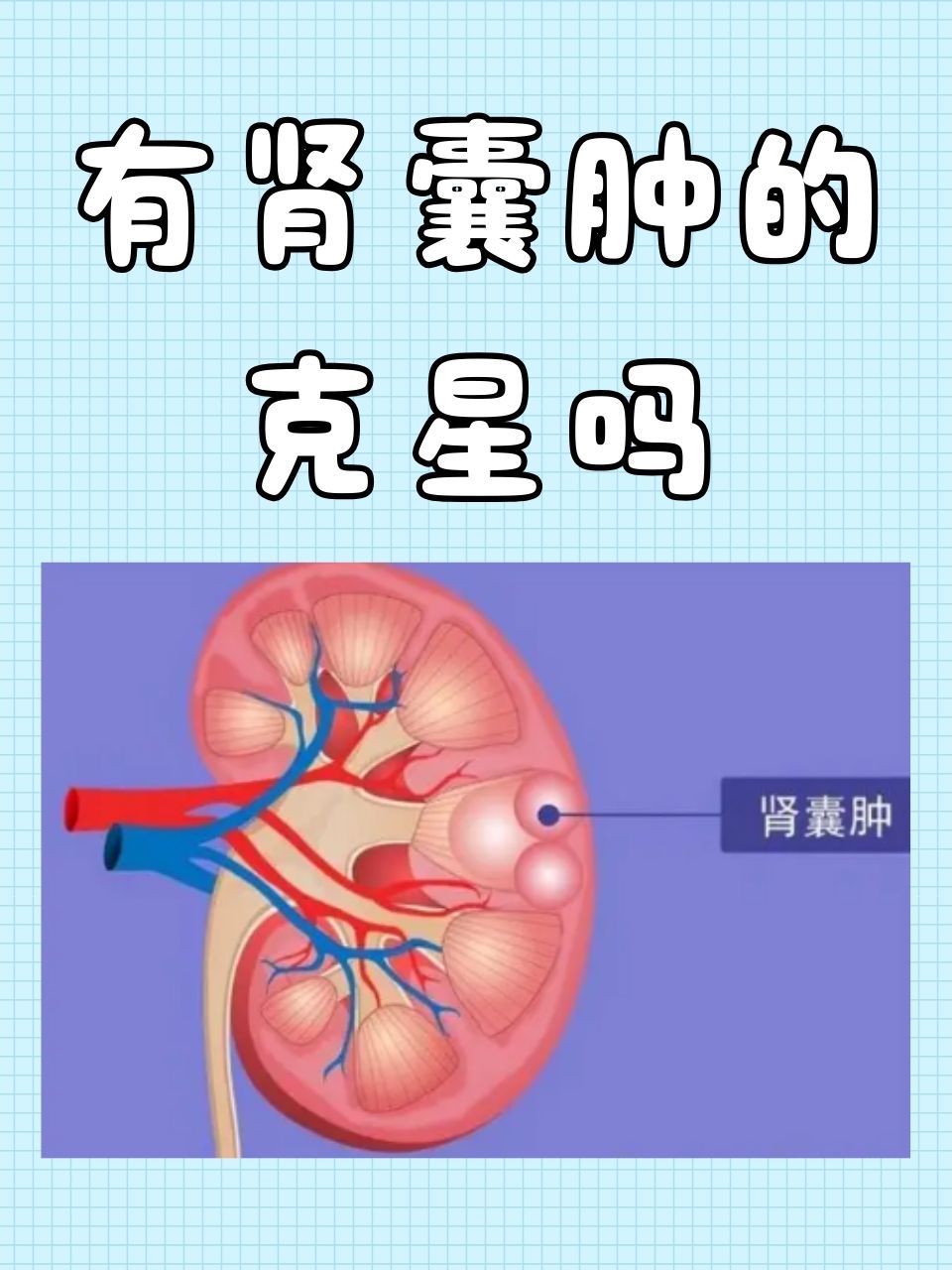 肾囊肿发病原因