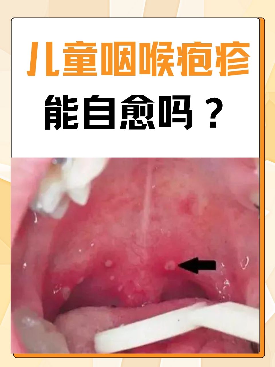 后博涛