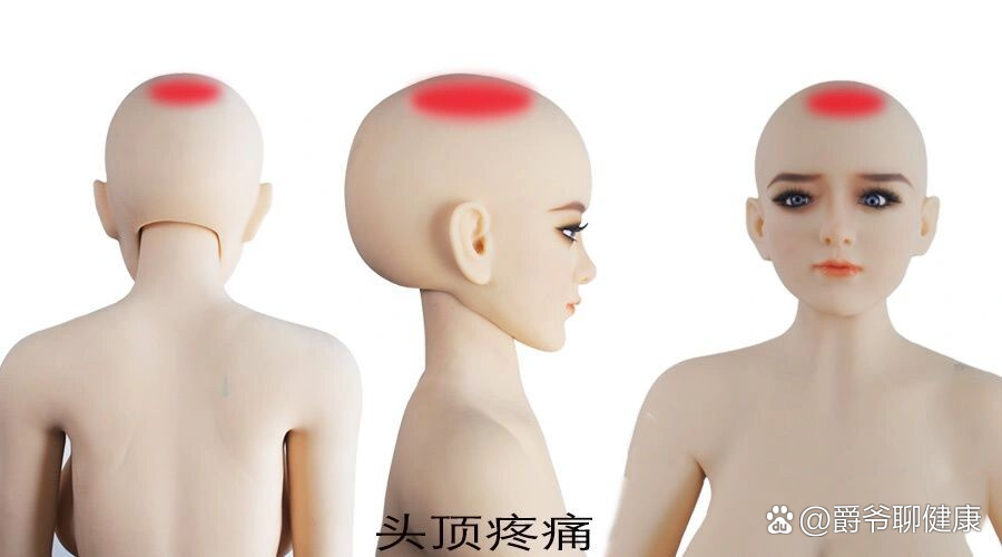 头顶正中疼痛是怎么回事