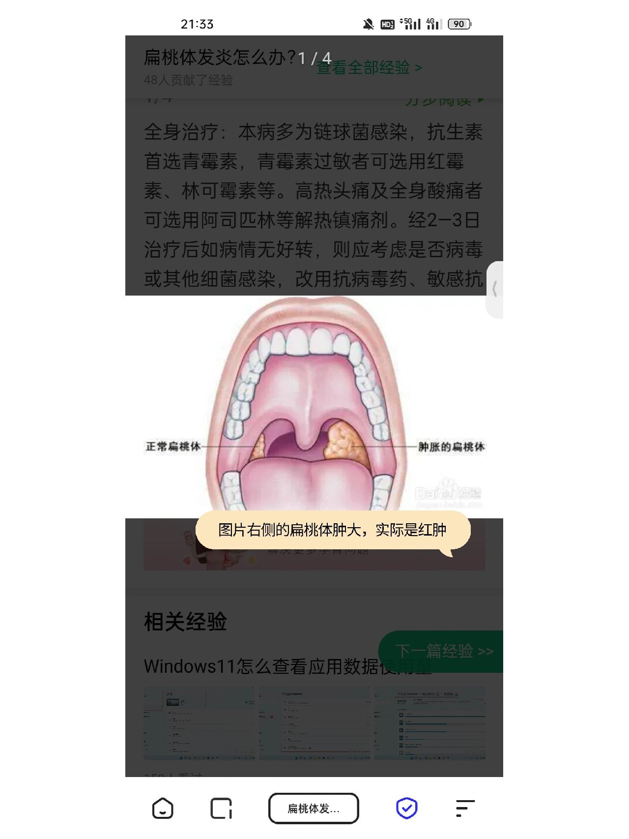 我也是扁桃体比较大,也不是经常发炎