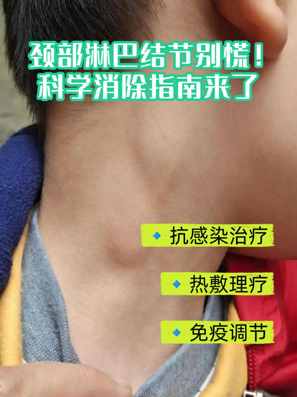颈部淋巴结肿大怎么治疗