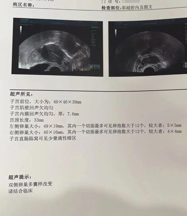 三个月没来月经很严重吗