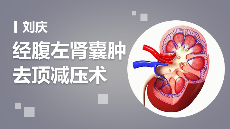 肾囊肿手术多少钱