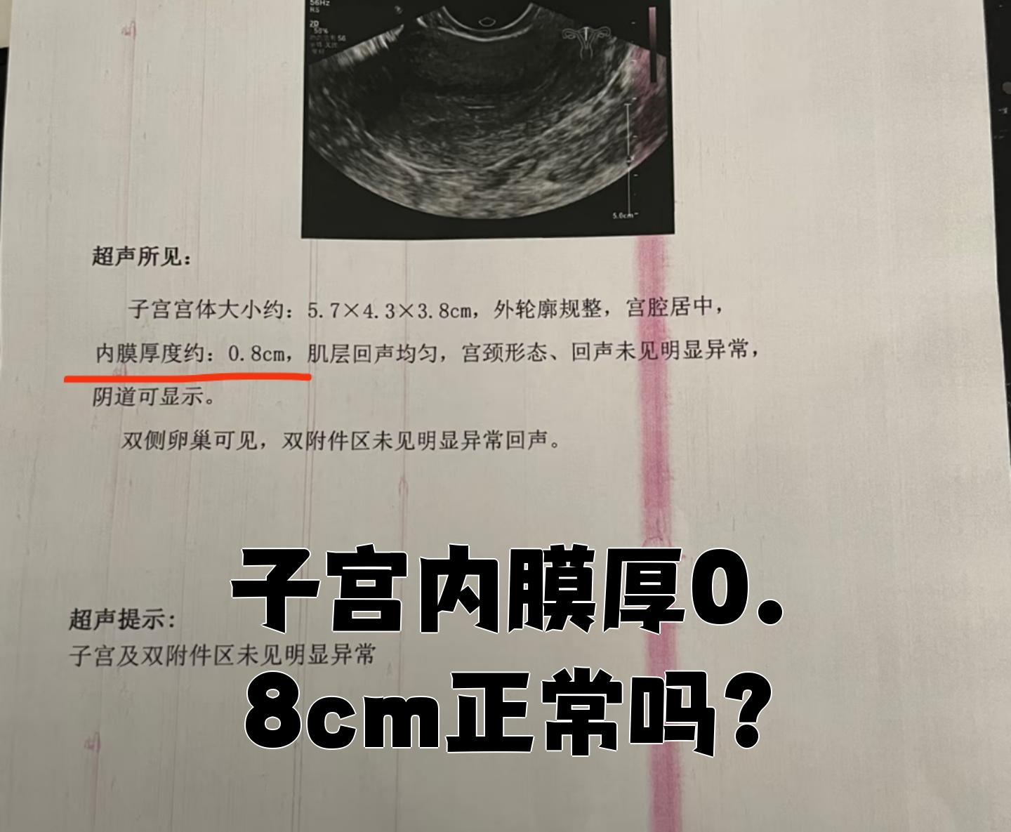 子宫内膜正常厚度