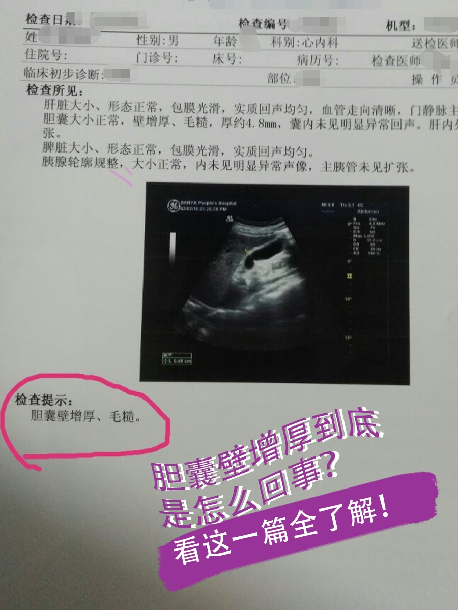 胆壁欠光滑是怎么回事?