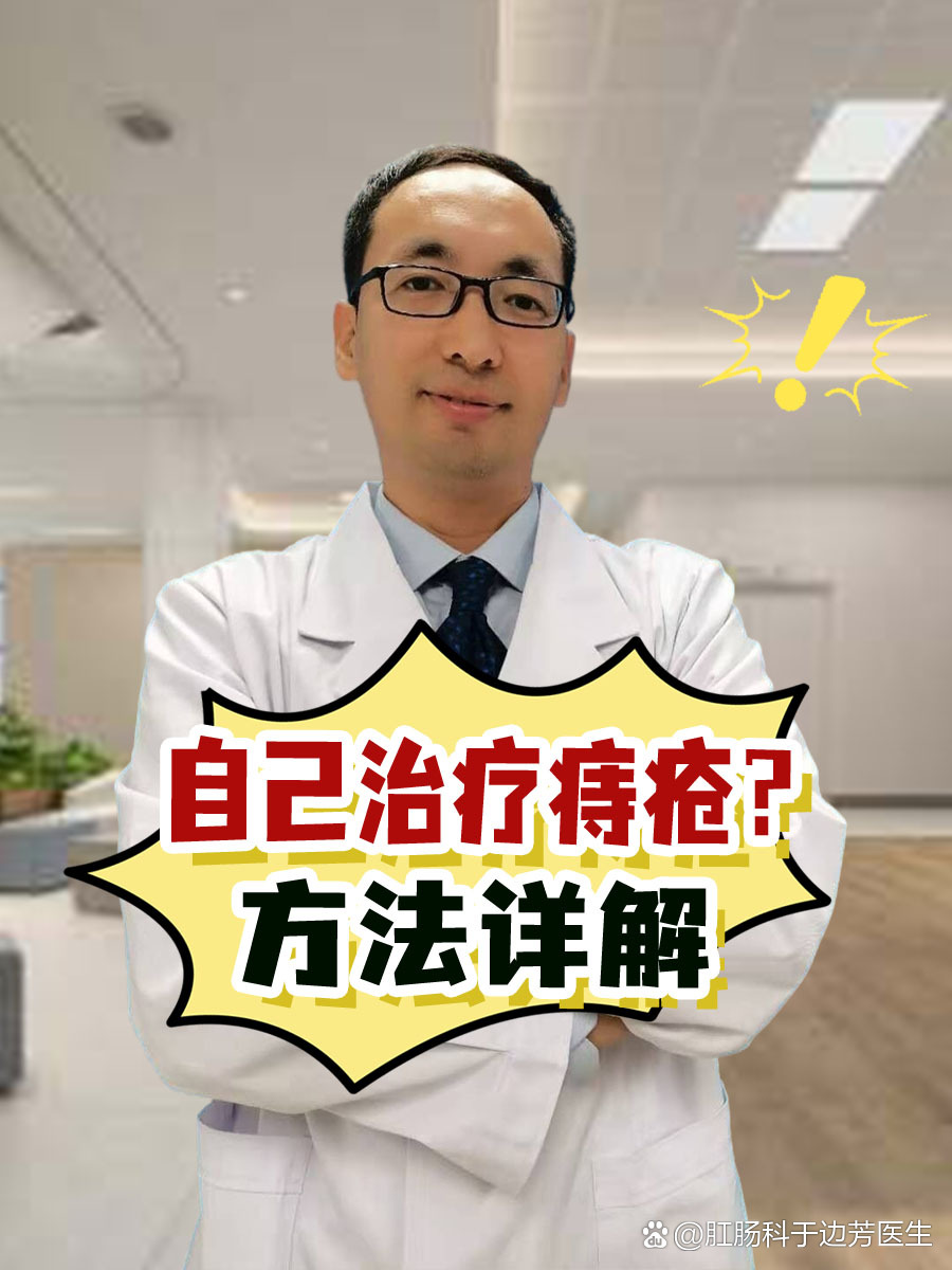 痔疮如何治疗才能除根?