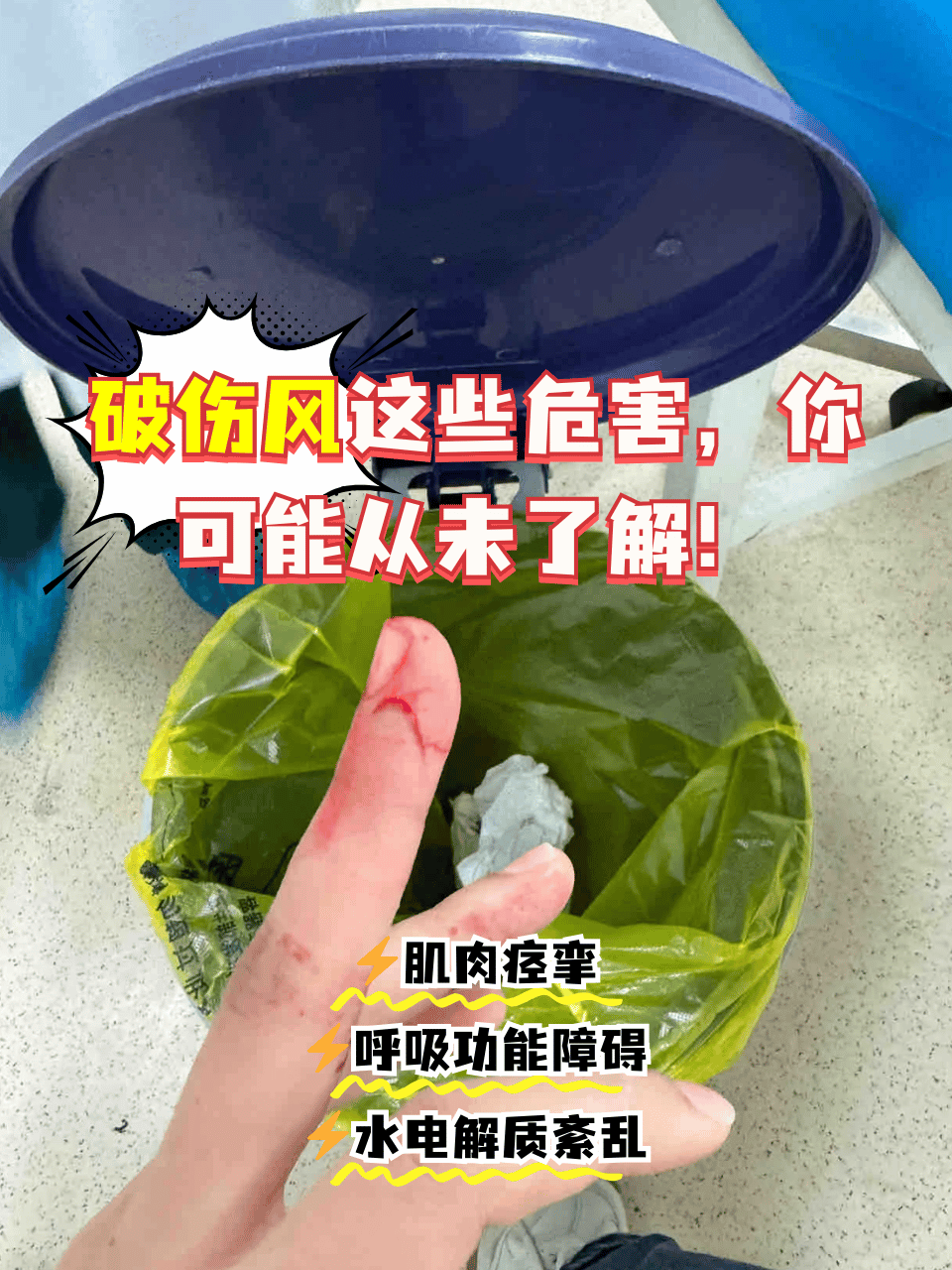 破伤风症状