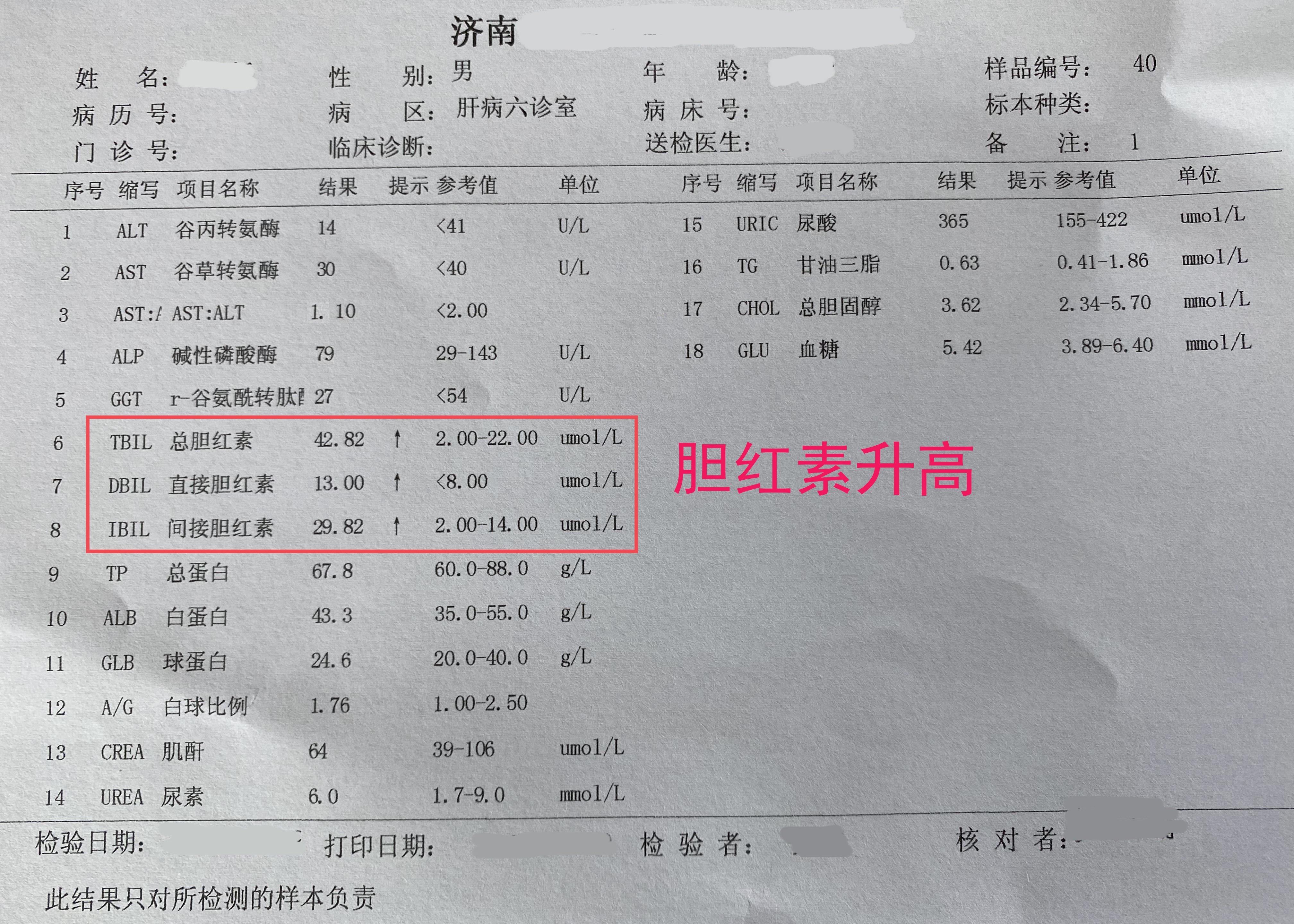 间接胆红素高是什么意思