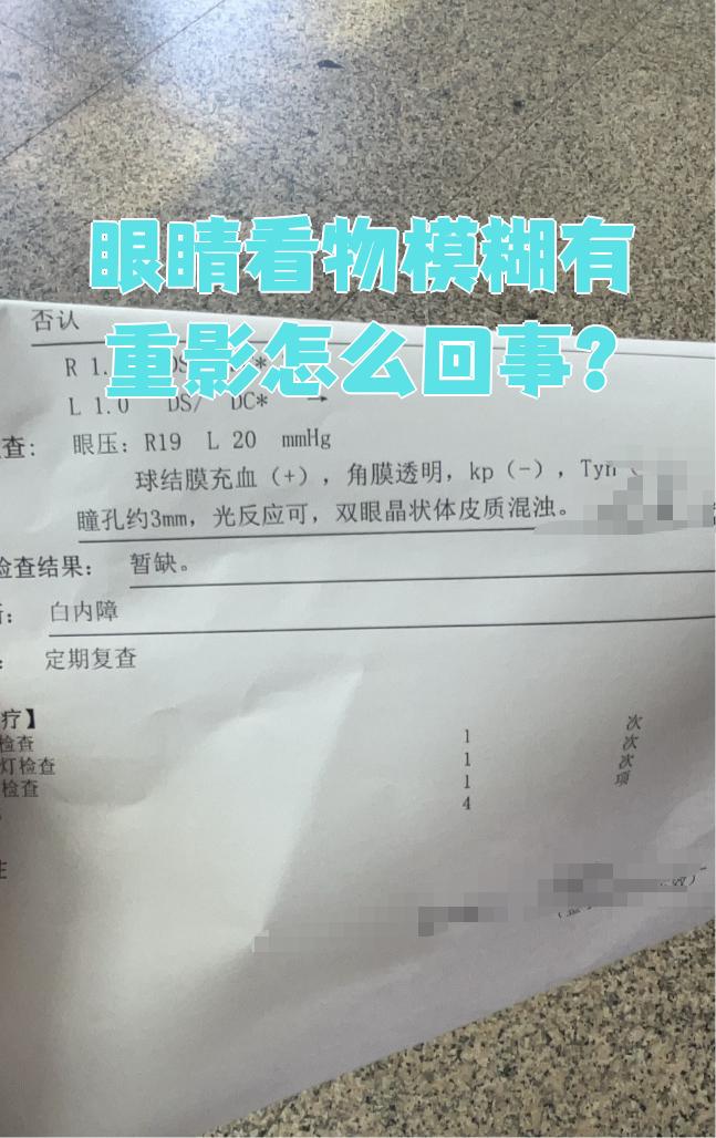 双眼看东西重影是怎么回事