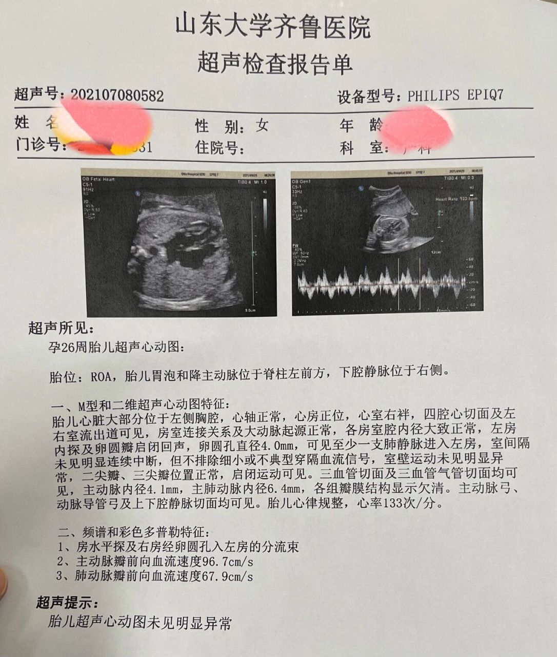 胎儿心脏彩超要多少钱