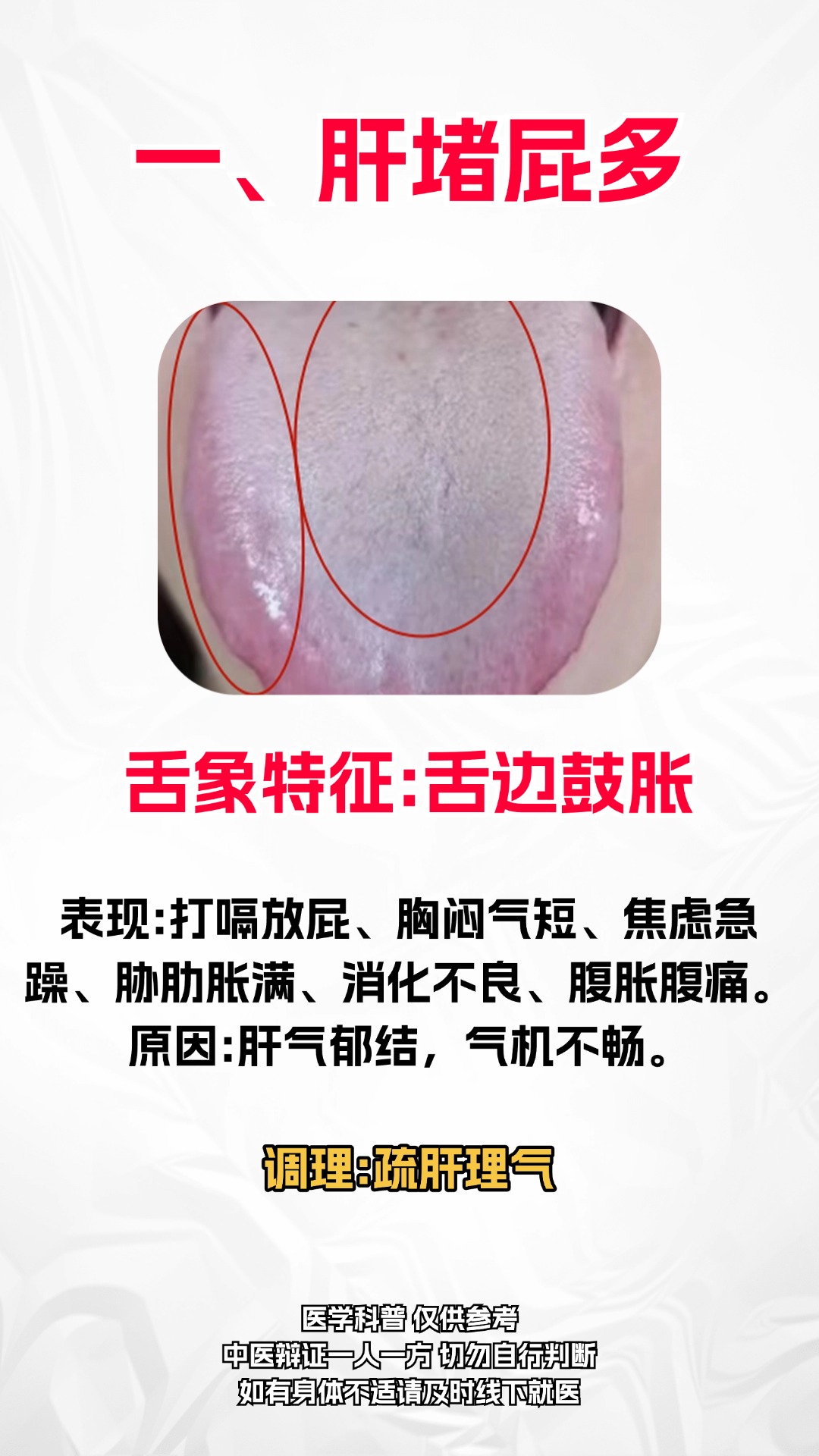 肝气不舒的症状有哪些