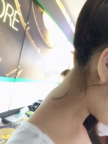 脖子后面的骨头突出