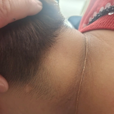 脖子后面的骨头突出