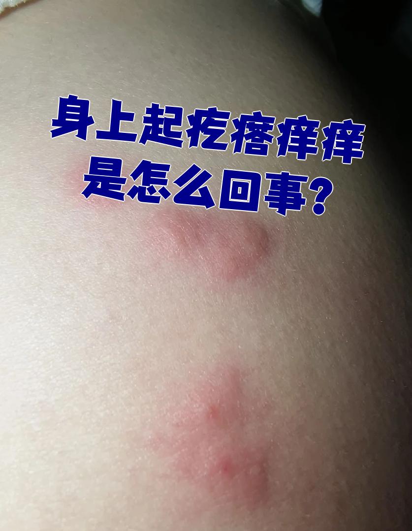 浑身痒是怎么回事