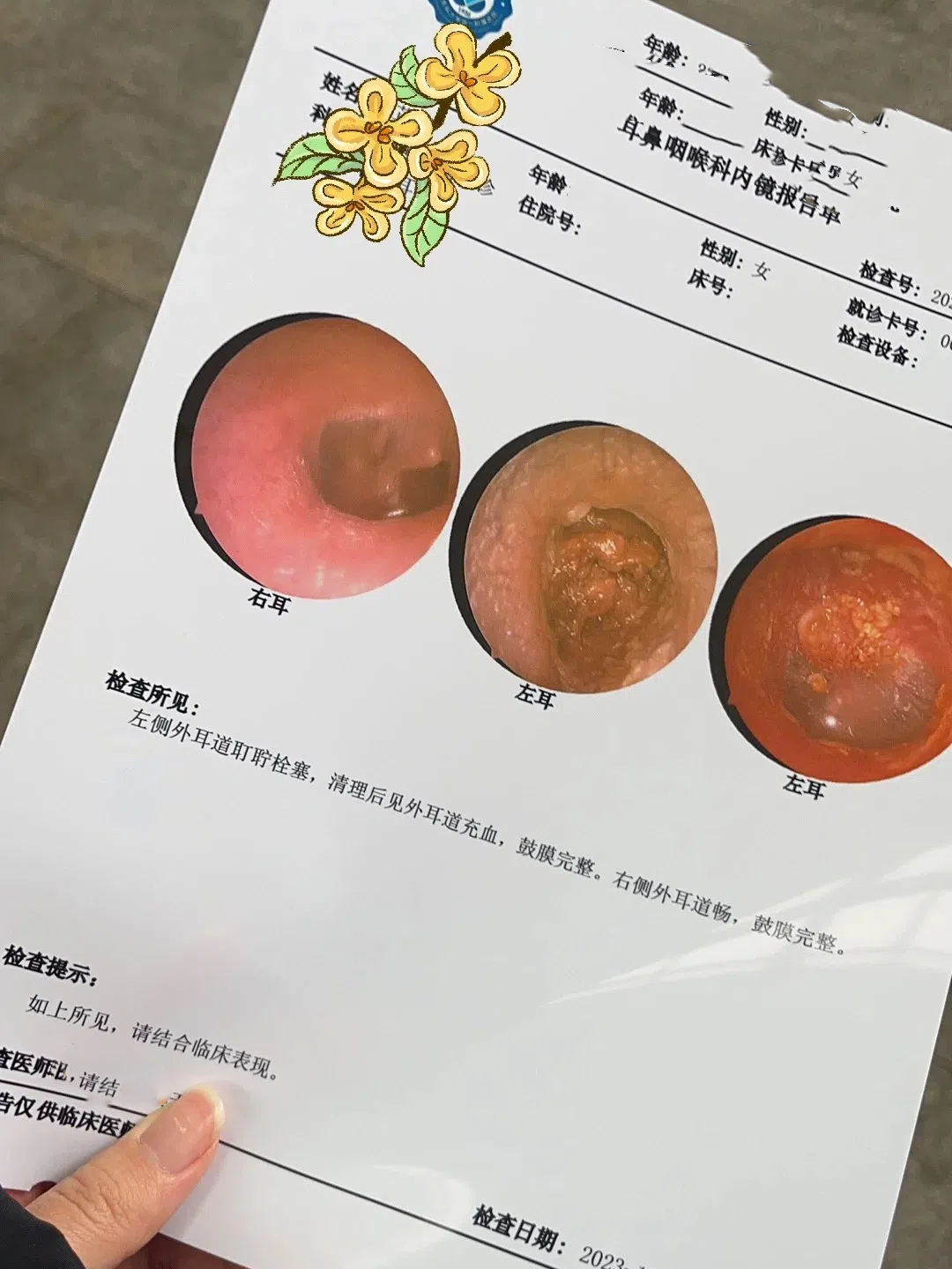 耳朵外面疼是怎么回事