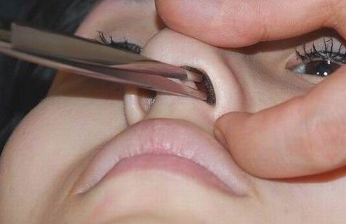 鼻毛会不会越剪越长