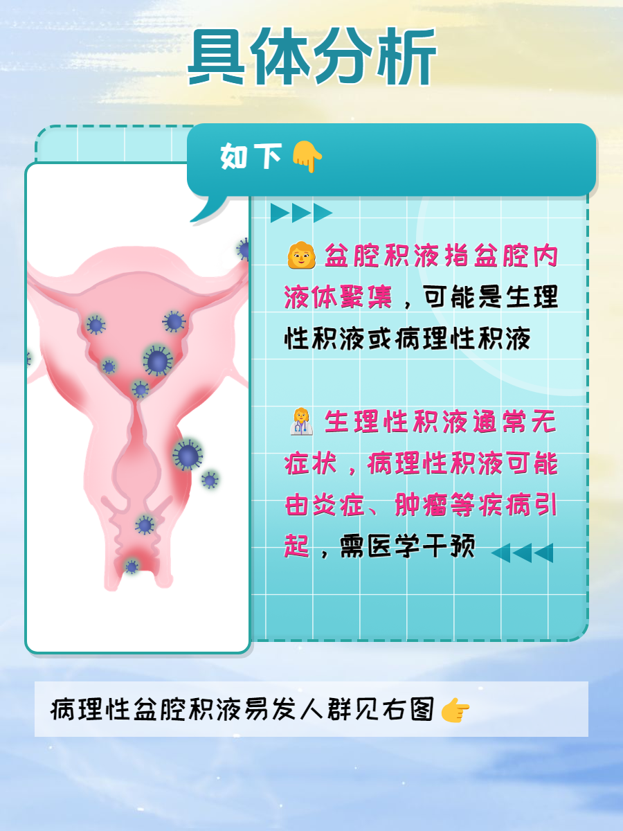 什么是子宫积液