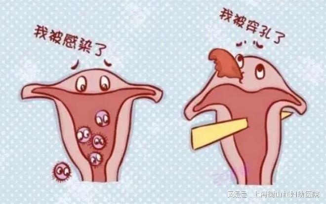 人流的危害是什么