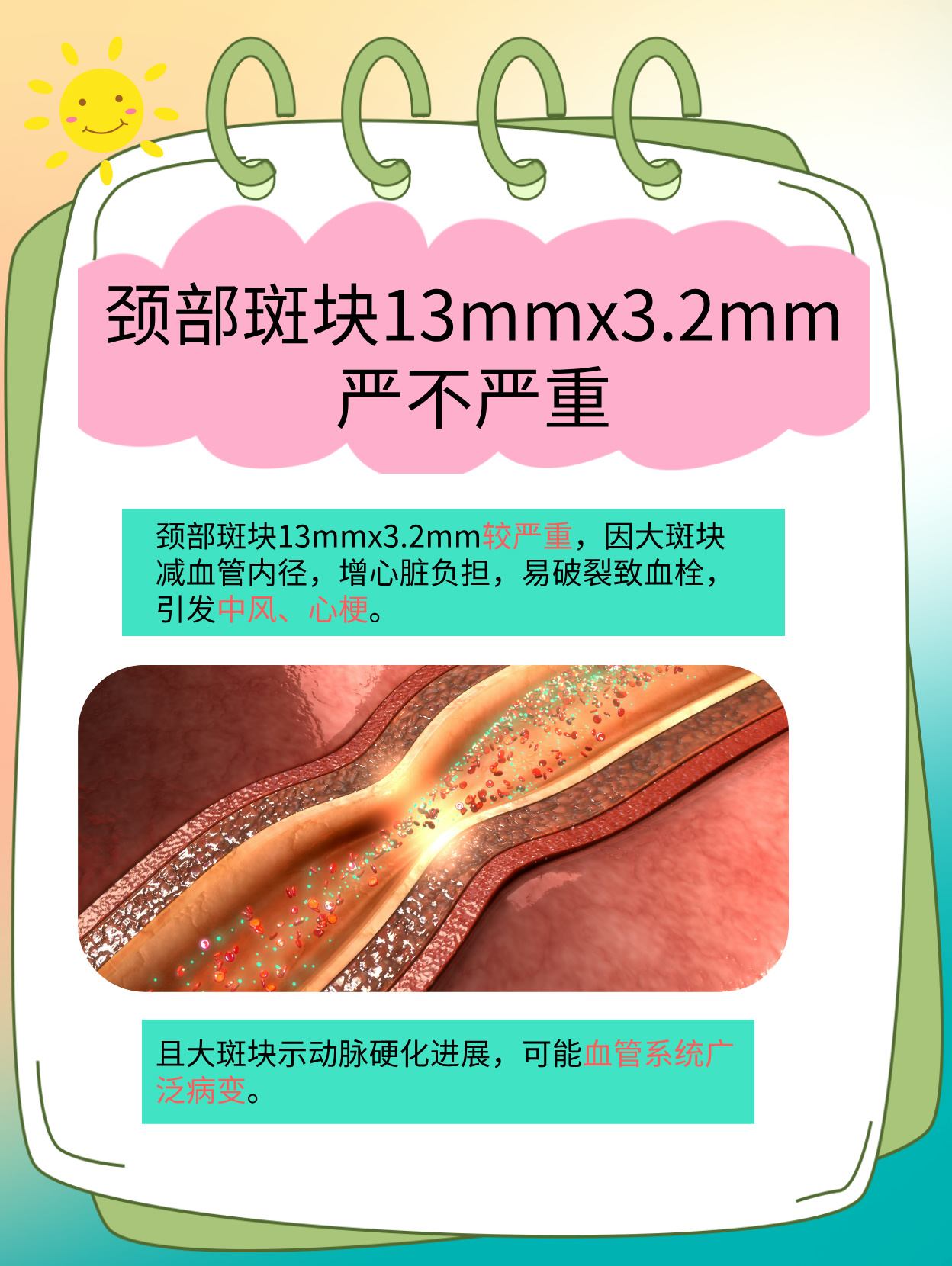 颈动脉斑块如何治疗