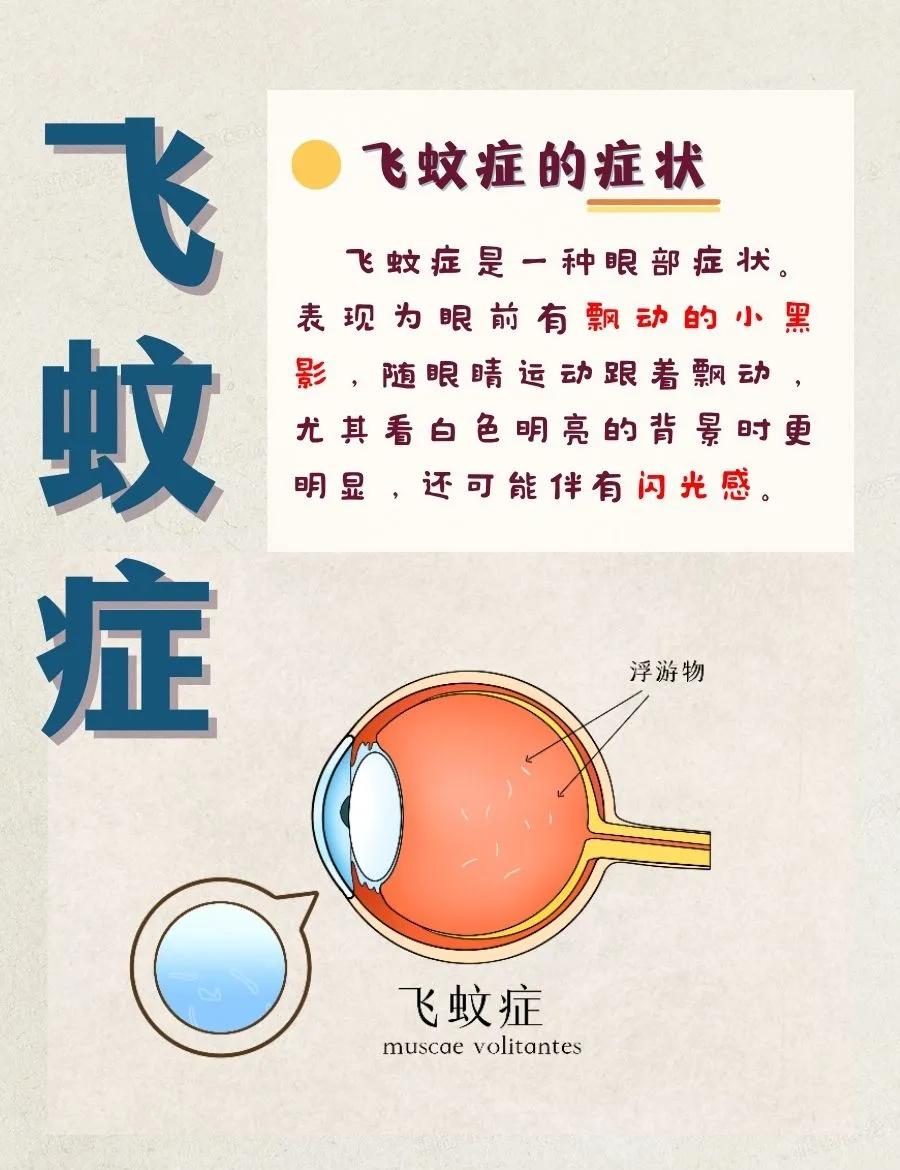 眼睛出现飞蚊怎么办?