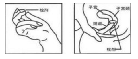 如何正确的清洗阴道