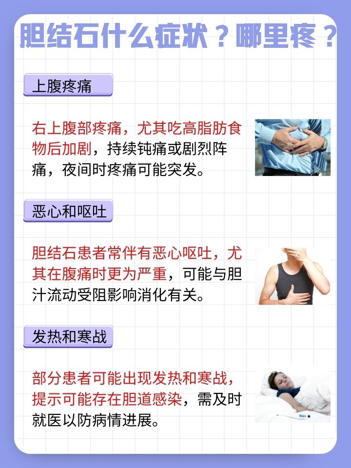胆管结石的症状是什么