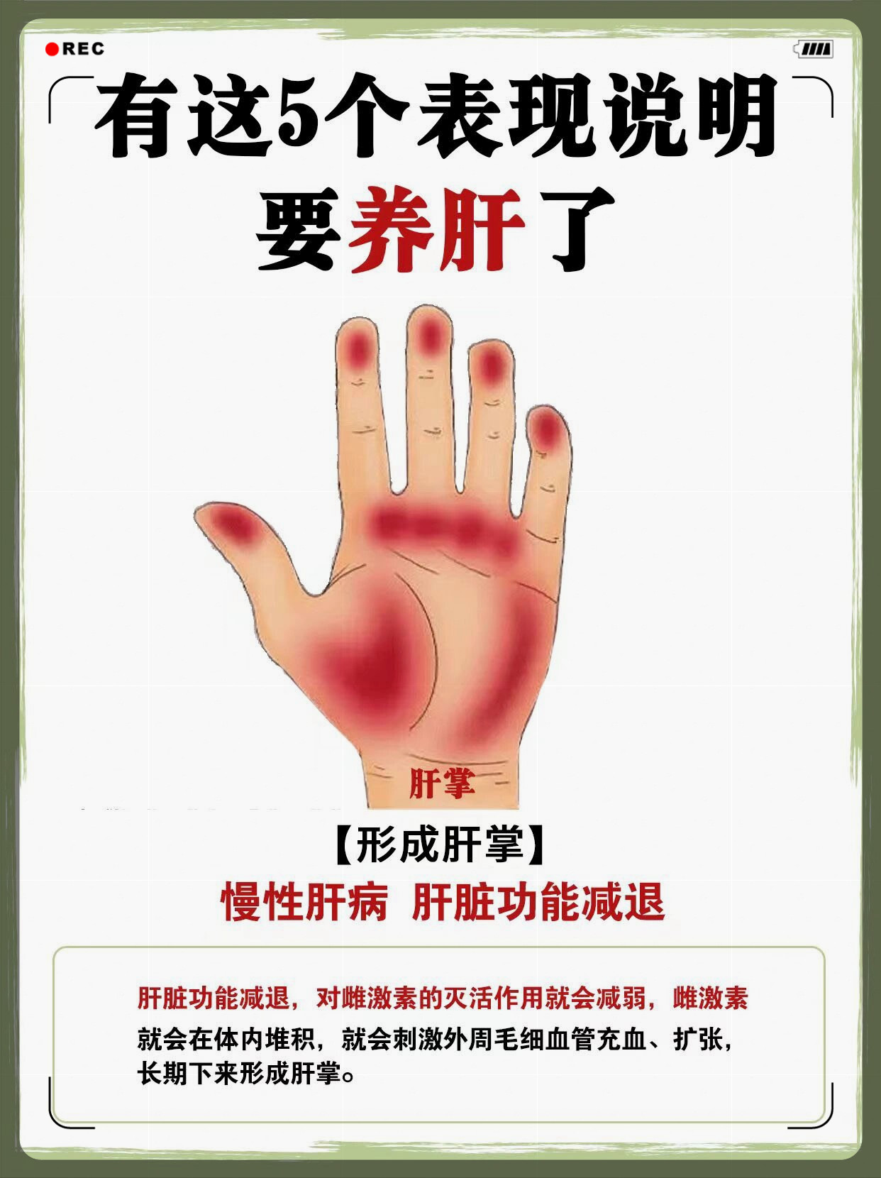 肝脏不好的症状