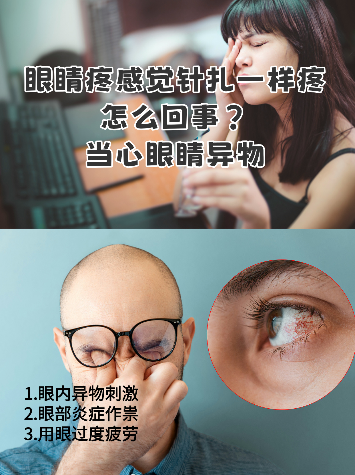 最近眼睛有点疼是怎么回事?