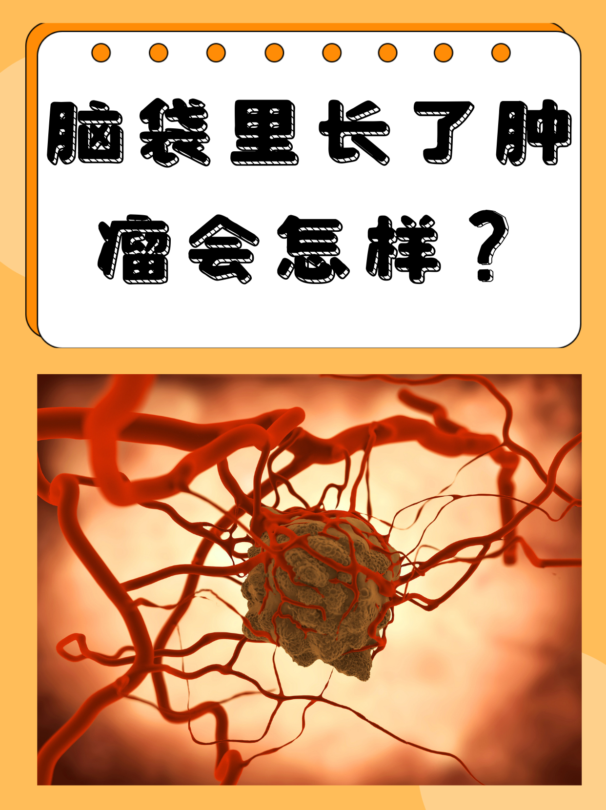 得了脑瘤后有哪些症状?