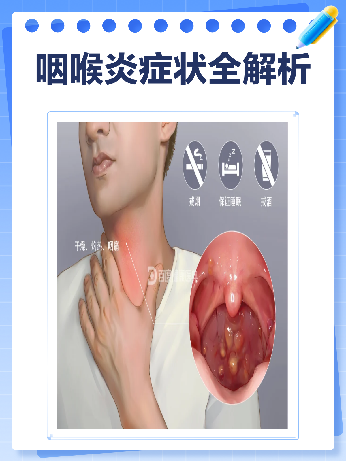 喉炎有哪些临床表现