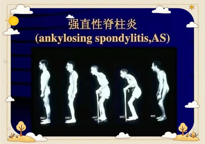 晋初珍