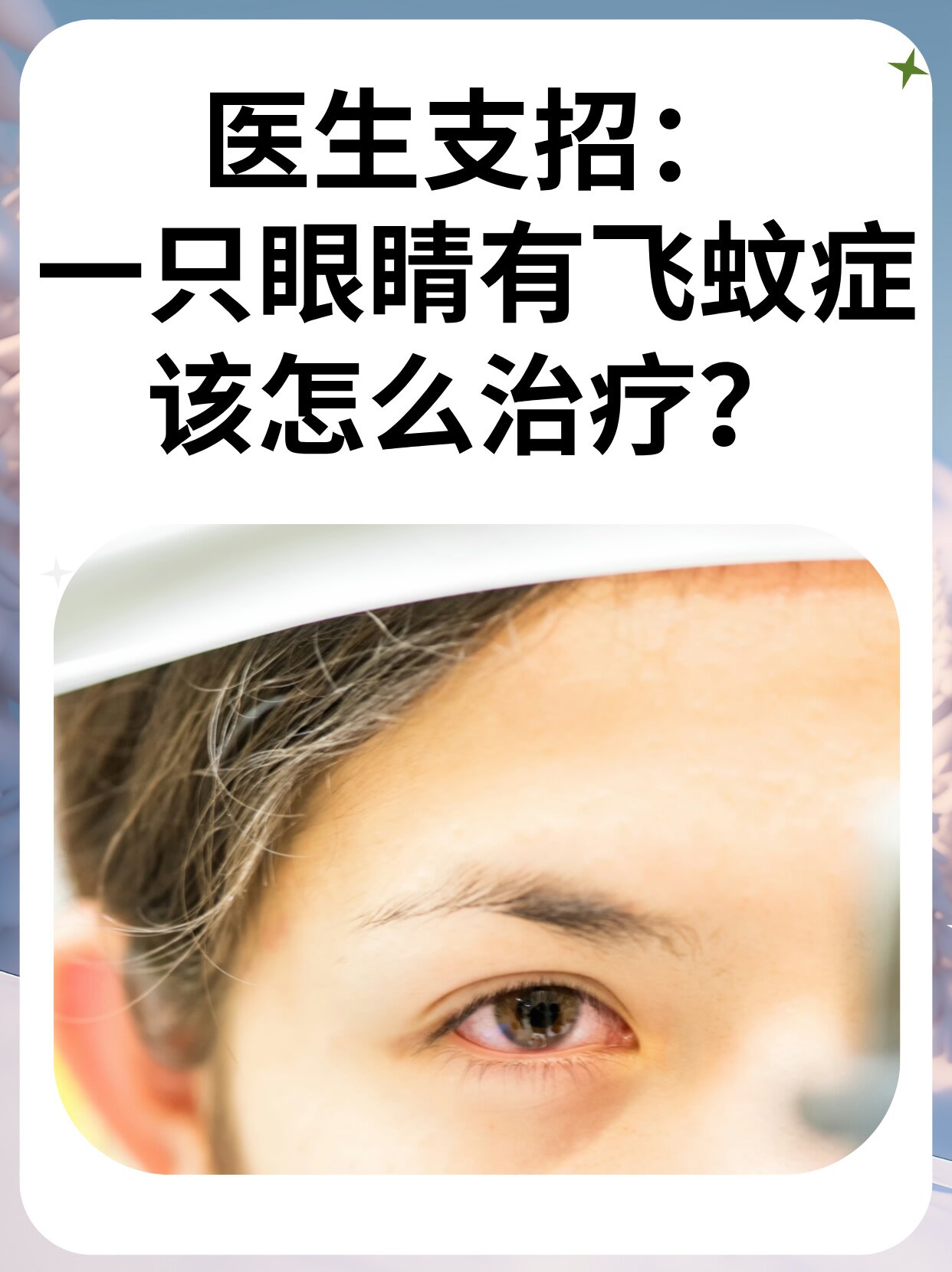 飞蚊症是什么原因