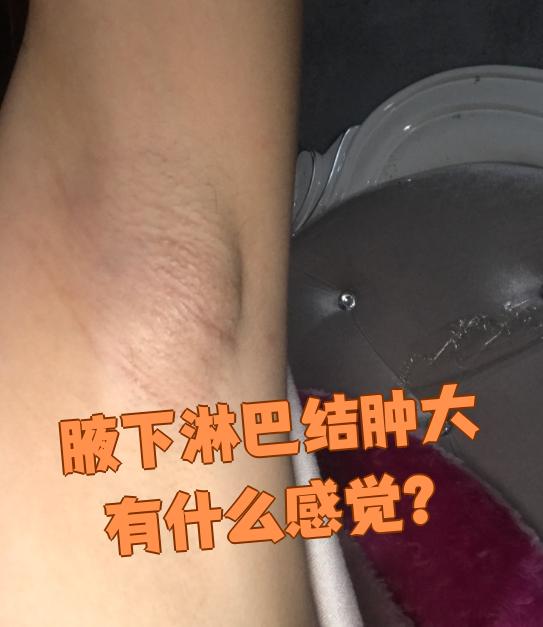 淋巴结发炎肿大,严重吗