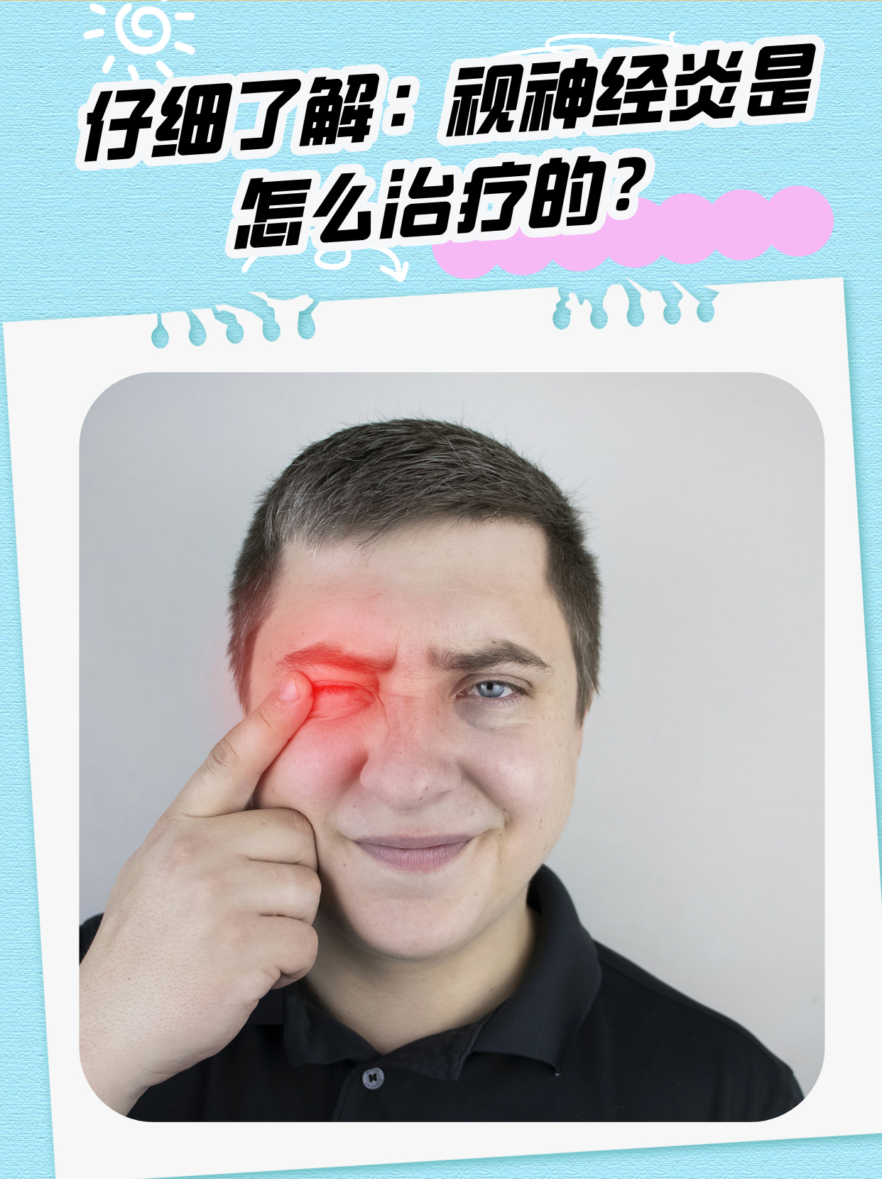 视神经脊髓炎能治愈吗