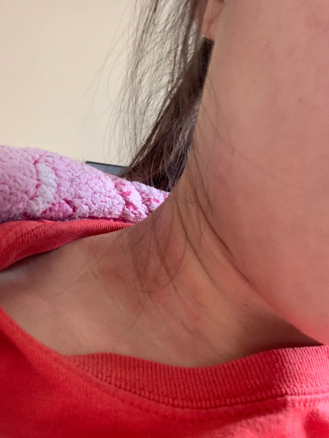 脖子痒是艾滋病的症状吗