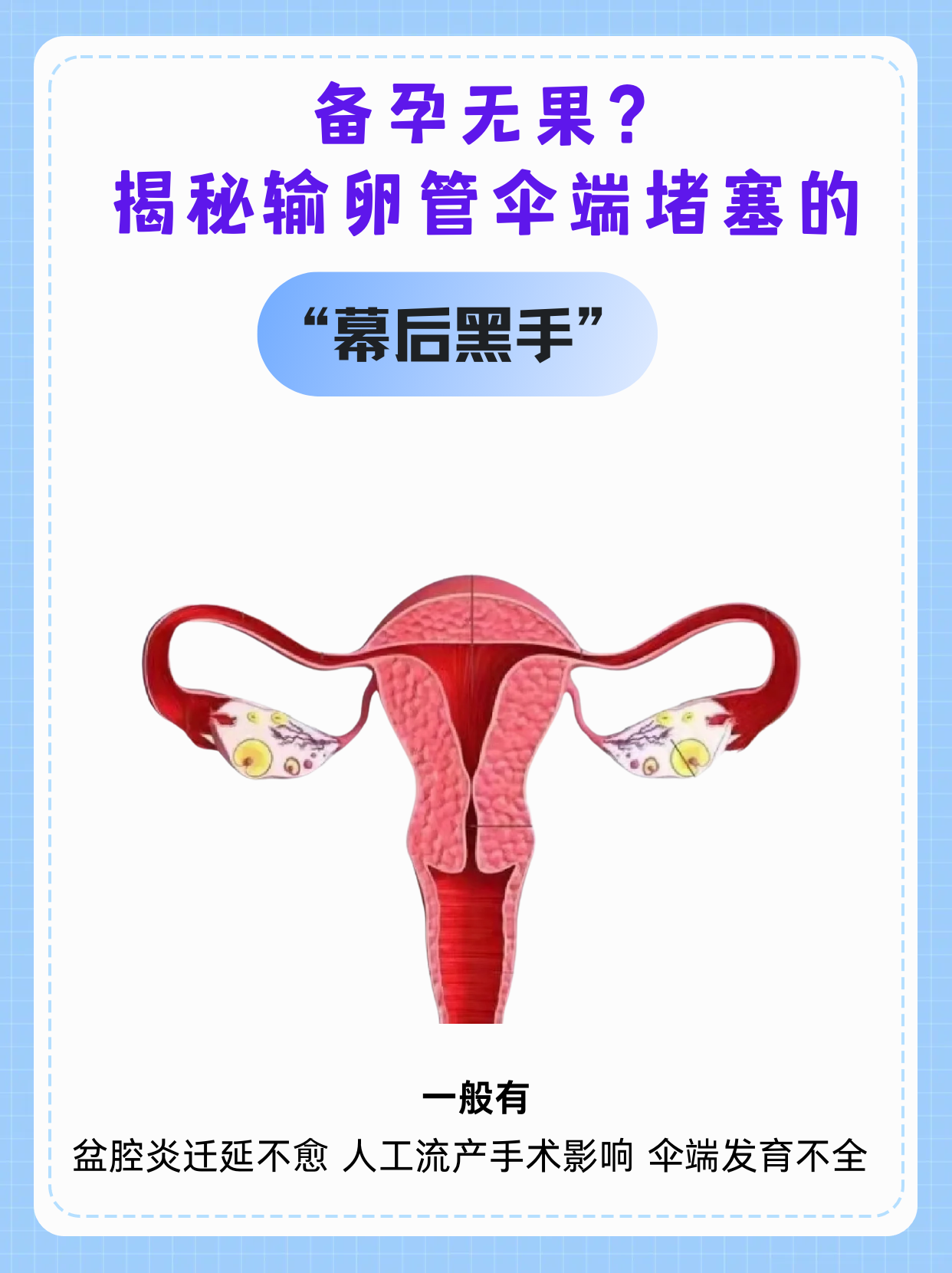 输卵管伞端粘连能治疗好吗