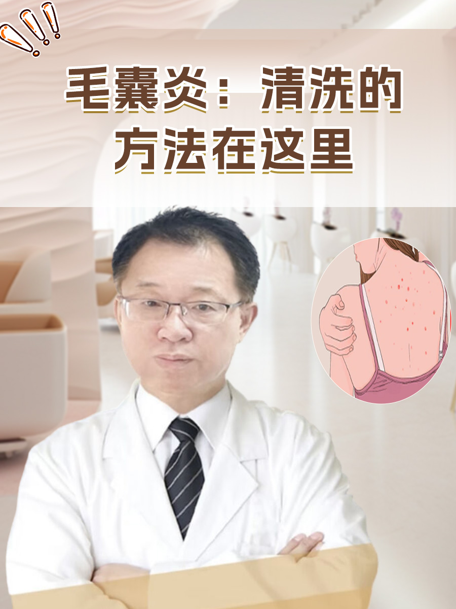 毛囊炎应该怎么治