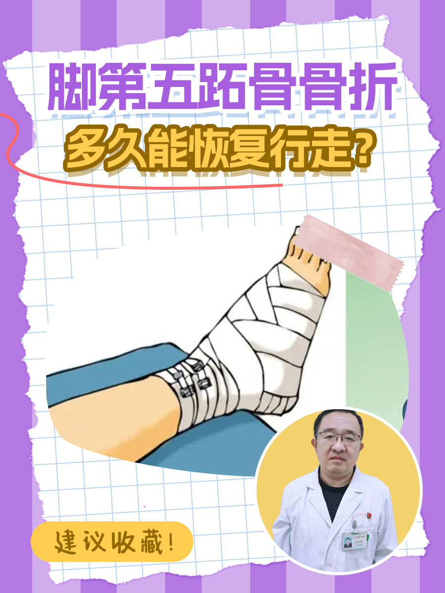 第五脚跖骨骨折愈合时间