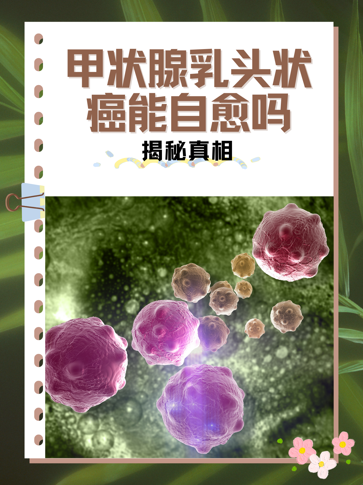 甲状腺癌可以治愈吗?