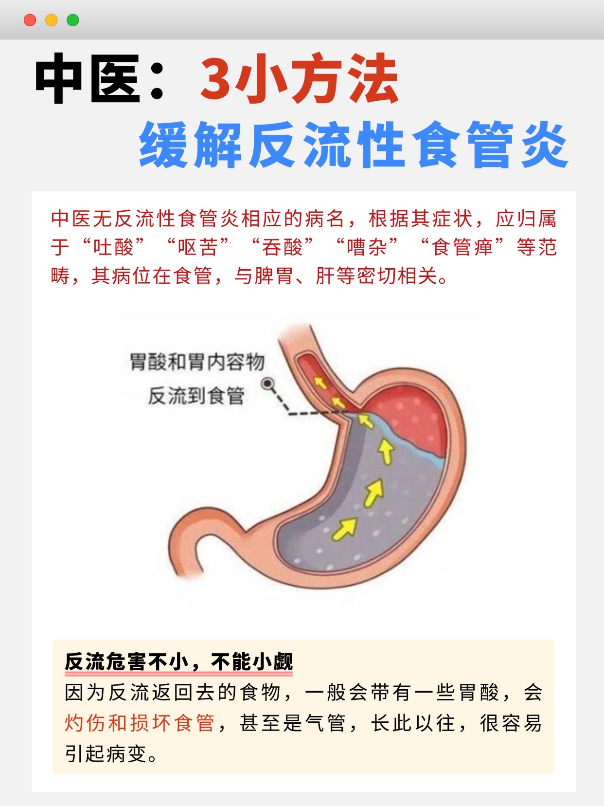 反流性食管炎b级严重吗