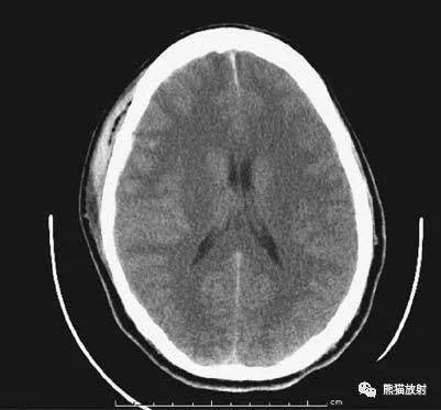 做一个头部ct需要多少钱