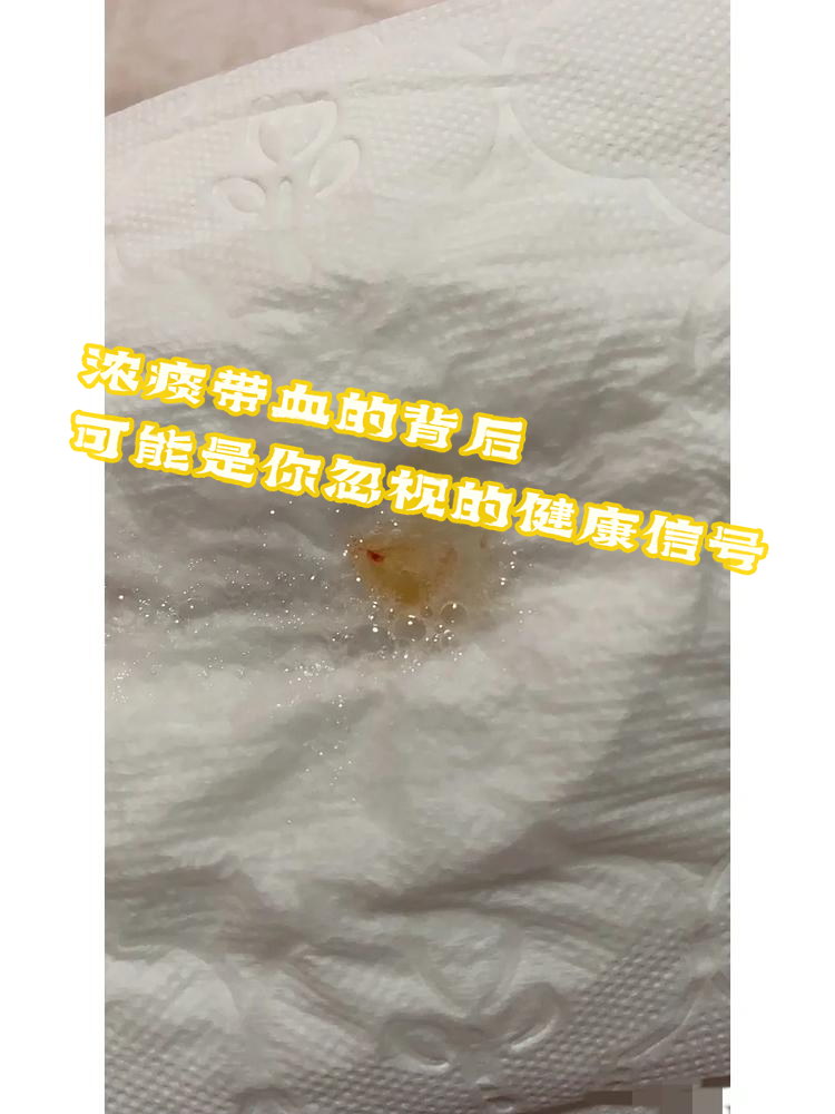 早晨起床有痰中带血,白天没有