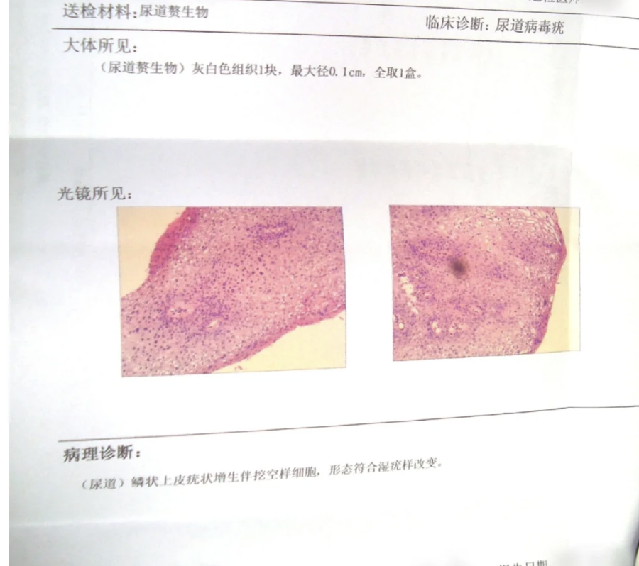 睾丸表皮有白色颗粒有瘙痒感