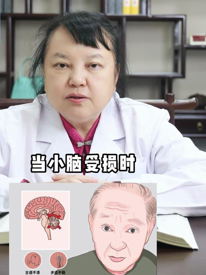 小脑性共济失调是什么意思