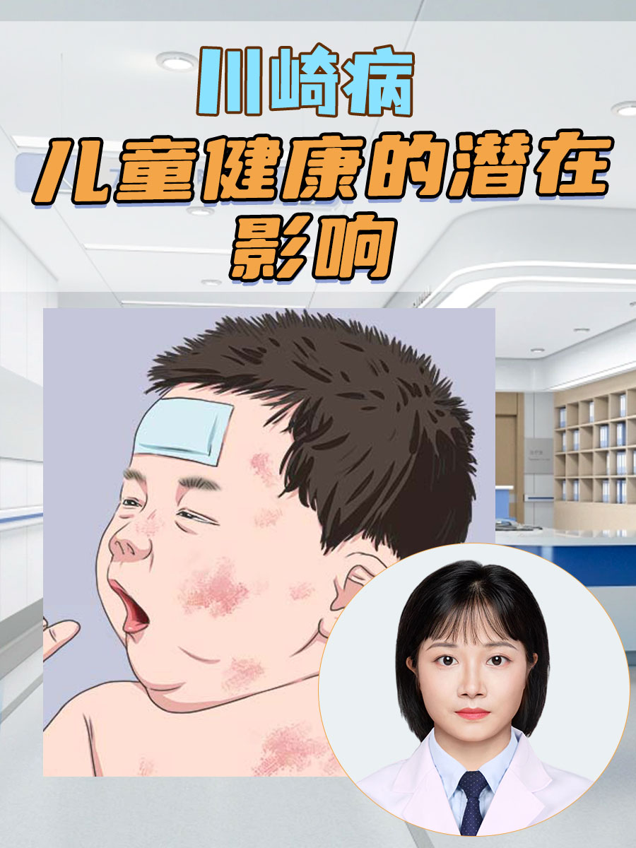 川崎症是什么病