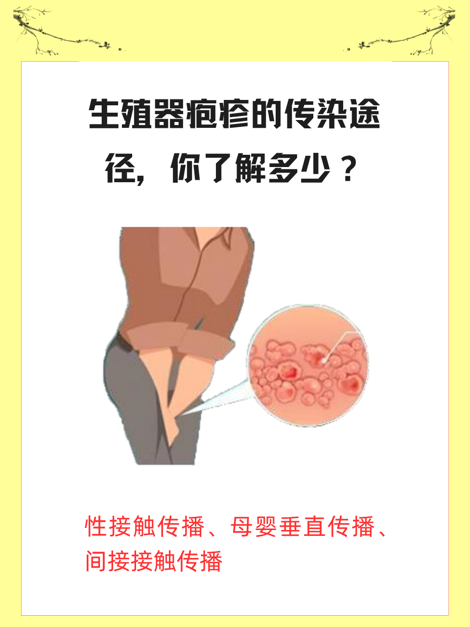 夷合美