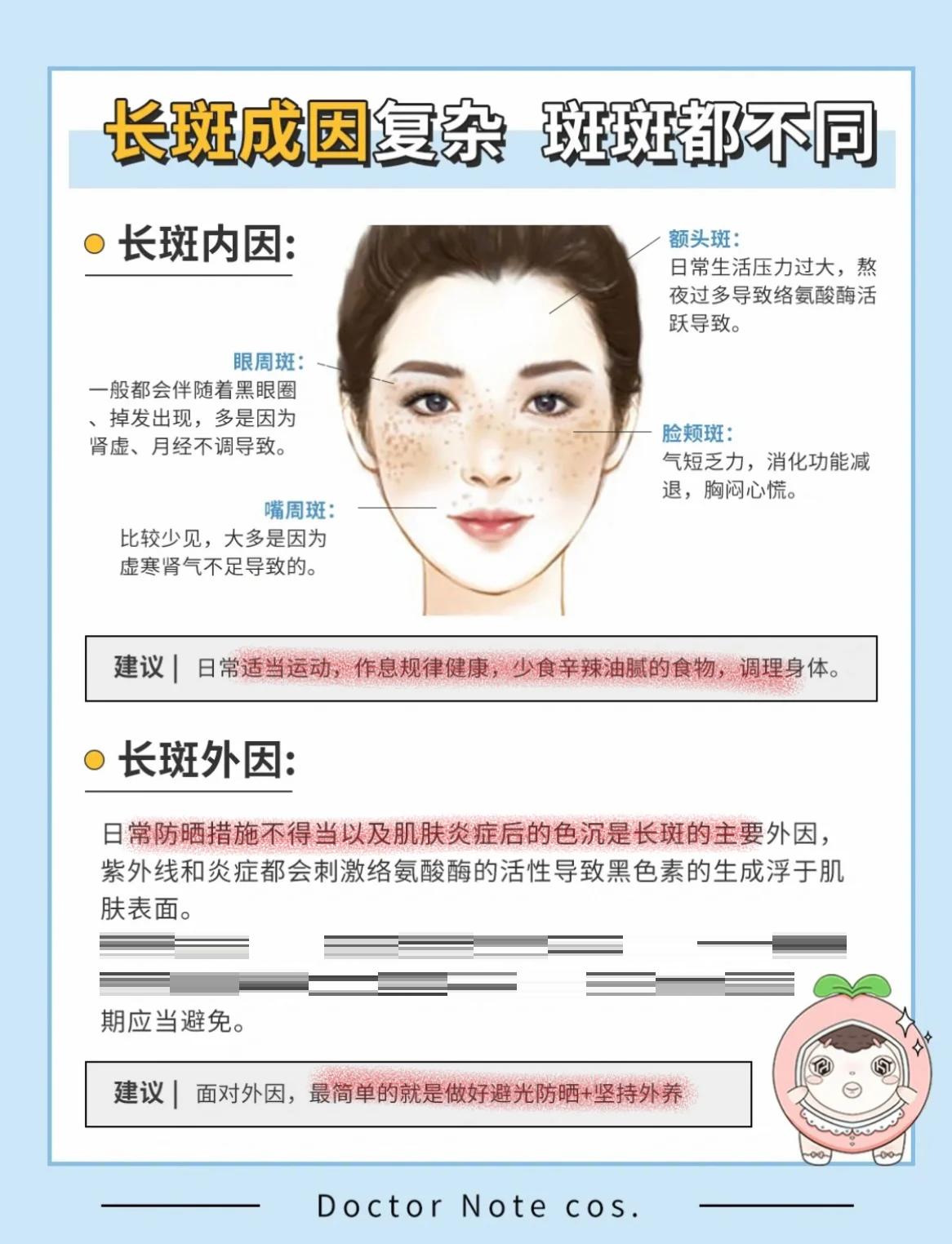 如何去掉雀斑